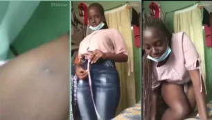 Mujer de República Dominicana con un gran trasero que parece estar hinchado